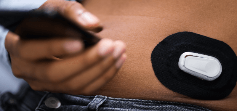 Diverse person wearing a CGM on their stomach while holding a smartphone monitor